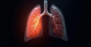 Drobnokomórkowy rak płuca – Objawy, diagnostyka i leczenie