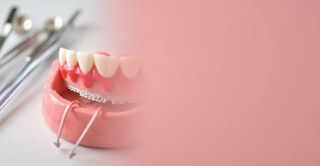 Rak dziąsła – Objawy, Diagnostyka i Leczenie