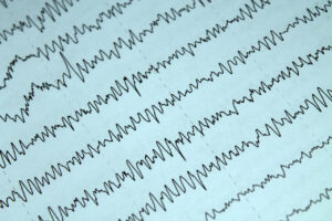 EEG – co to za badanie i co pokazuje zapis fal mózgowych?